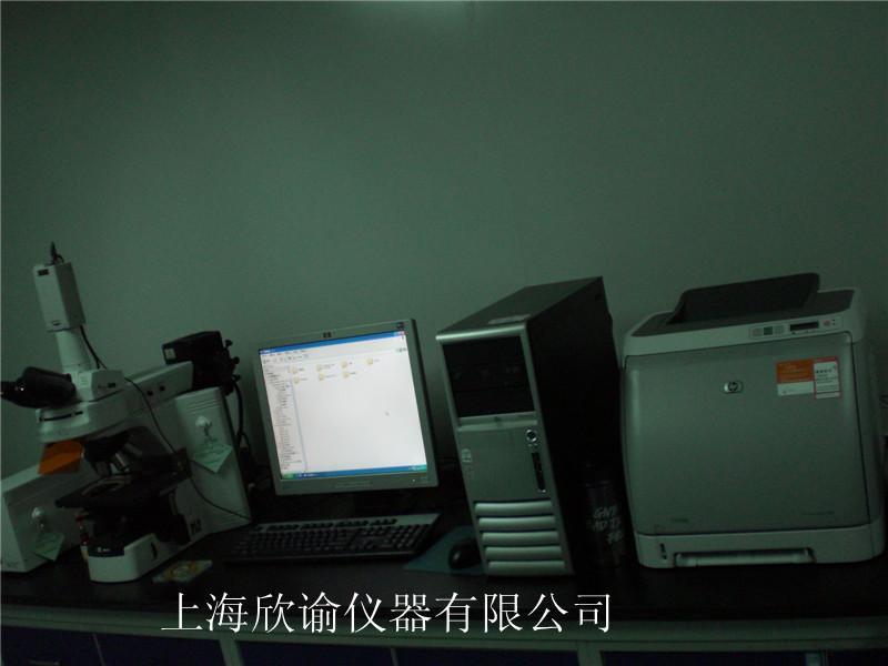 上海染色体分析系统，欣谕图像分析系统，核型分析系统