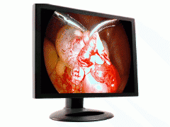 狼牌,史塞克,沈大内窥镜专用魔言21寸液晶监视器图1