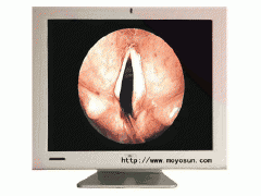 狼牌,史托斯,桐庐内窥镜专用魔言17寸液晶监视器图1