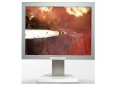 狼牌,史塞克,沈大内窥镜专用魔言24寸液晶监视器图1