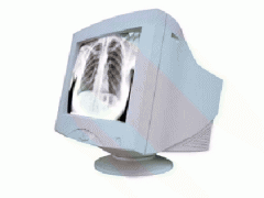 西门子Iconos R200数字胃肠17寸CRT显示器图1