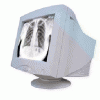 西门子Iconos R200数字胃肠17寸CRT显示器