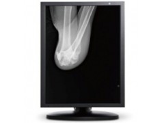 飞利浦Digital Diagnsot DR影像处理3M竖屏图1