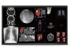 东芝DFP 60A/2000A大C臂影像监测42寸显示器图1