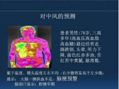 医用热像仪一眼看穿肠胃健康图1