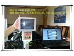 便携式X光机便携X光机威海张弓:幺三零邀三五七七六二五图1
